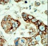 EPHA2 / EPH Receptor A2 Antibody (aa30-60)