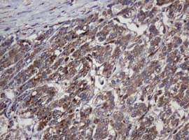 CRYAA / Alpha A Crystallin Antibody (clone OTI2C3)