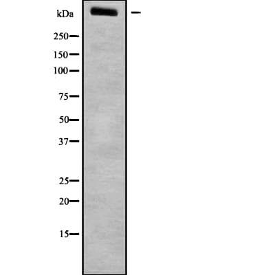 Polyclonal Rabbit anti-Human LRP1B Antibody (WB)