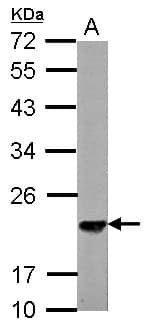 SKP1 Antibody