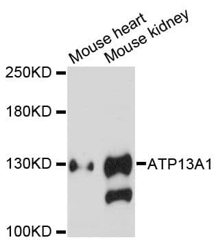 ATP13A1 Antibody