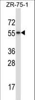 RORB / ROR Beta Antibody (aa329-358)