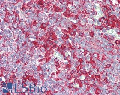 IHC-plus™ SIPA1L3 Antibody (aa1731-1781)