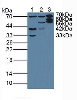 PLS3 / T Plastin Antibody (aa379-630)