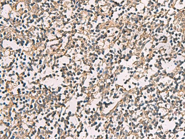 CKLFSF4 / CMTM4 Antibody