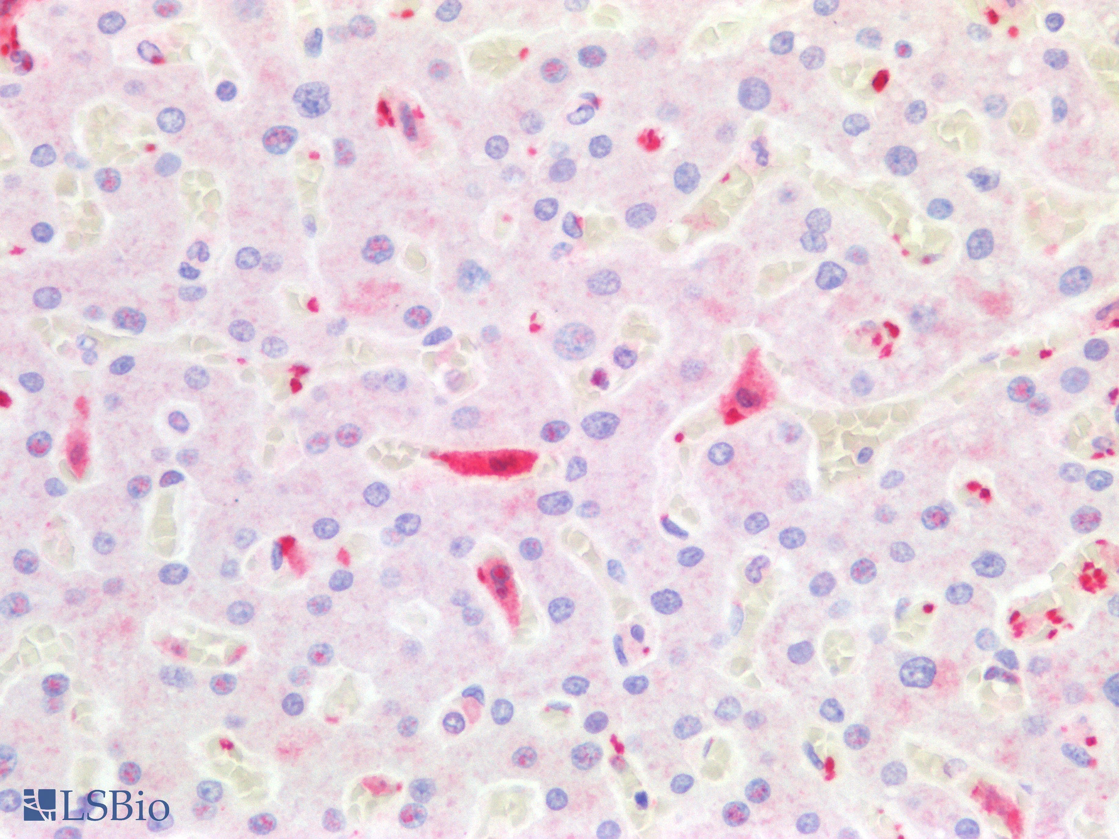 PathPlus™ Monoclonal Mouse anti-Human F13A1 / Factor XIIIa Antibody (IHC)