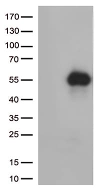 Monoclonal Mouse anti-Human HAVCR2 / TIM-3 Antibody (clone OTI7B10, Carrier-free, WB)