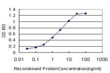 FADS3 Antibody (clone 3D2)