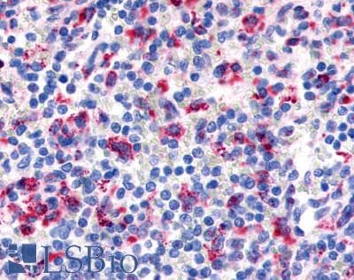 PathPlus™ Polyclonal Rabbit anti-Human ADGRE3 / EMR3 Antibody (N-Terminus, IHC)