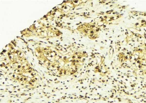 Vitamin D Receptor / VDR Antibody