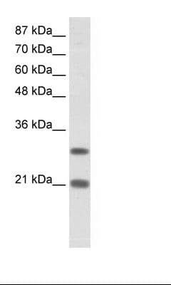 MSX2 / MSH Antibody (N-Terminus)
