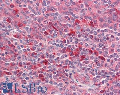 IHC-plus™ Polyclonal Rabbit anti-Human C11orf73 Antibody (aa1-197, IHC)