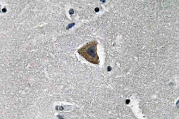 Rho Kinase / ROCK1 Antibody (Asn311)
