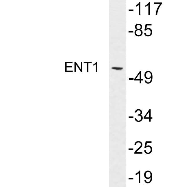 SLC29A1 / ENT1 Antibody (aa15-64)