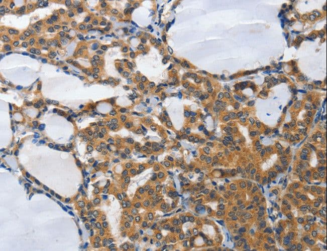 Polyclonal Rabbit anti-Human PIAS2 / PIASX Antibody (IHC)