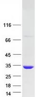Human KCTD6 Protein (Recombinant Myc-DDK (Flag))