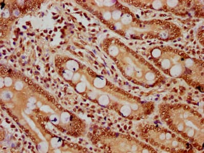 Polyclonal Rabbit anti-Human HIST1H2BN Antibody (IHC)