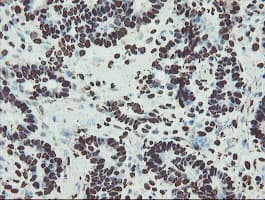 Monoclonal Mouse anti-Human NONO / P54NRB Antibody (clone OTI2E7, IHC, WB)
