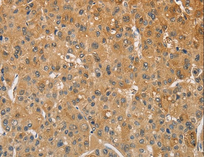 Polyclonal Rabbit anti-Human AMZ2 Antibody (IHC)