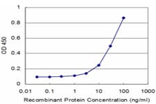 MVK Antibody (clone 2C5)
