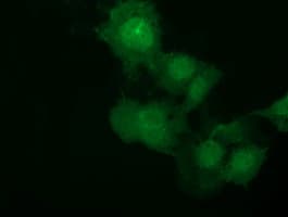 MMS21 / NSMCE2 Antibody (clone OTI4H9)