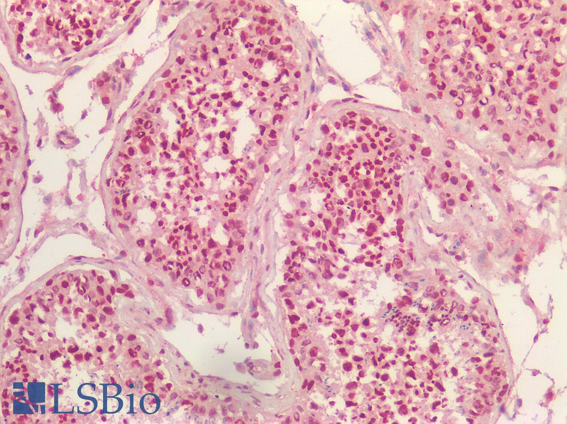 SCN9A / Nav1.7 Antibody