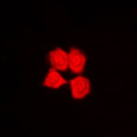 IHC-plus™ Polyclonal Rabbit anti-Human PKN1 Antibody (aa246-285, IHC, IF, WB)