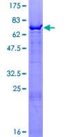 Human ZBTB37 Protein (Recombinant GST)
