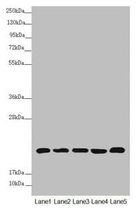 Polyclonal Rabbit anti-Human NDUFB5 Antibody (IHC, IF, WB)