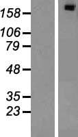 E6TP1 / SIPA1L1 Protein (Over-Expression Lysate Myc-DDK (Flag))