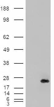 IHC-plus™ CSRP2 Antibody (aa86-97)