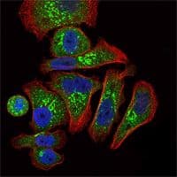 EPO / Erythropoietin Antibody (clone 4F11)
