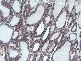 APMAP / C20orf3 Antibody (clone OTI1A9)