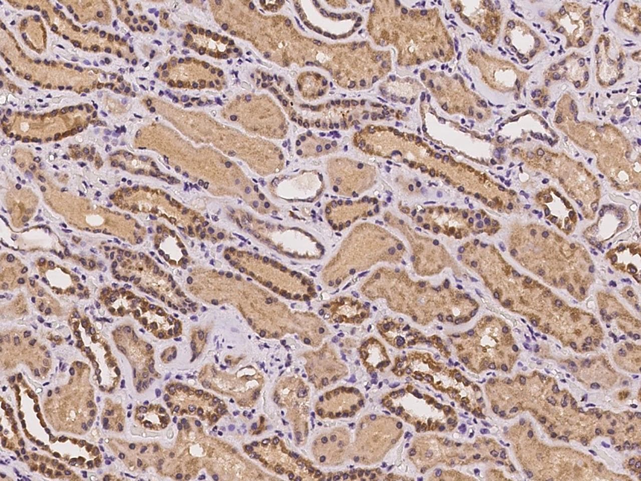AZI2 / NAP1 Antibody