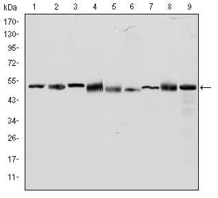 CCT2 / CCT Beta Antibody (clone 5B5C4)