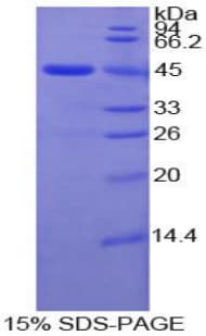 Human MMP10 Protein (Recombinant His)