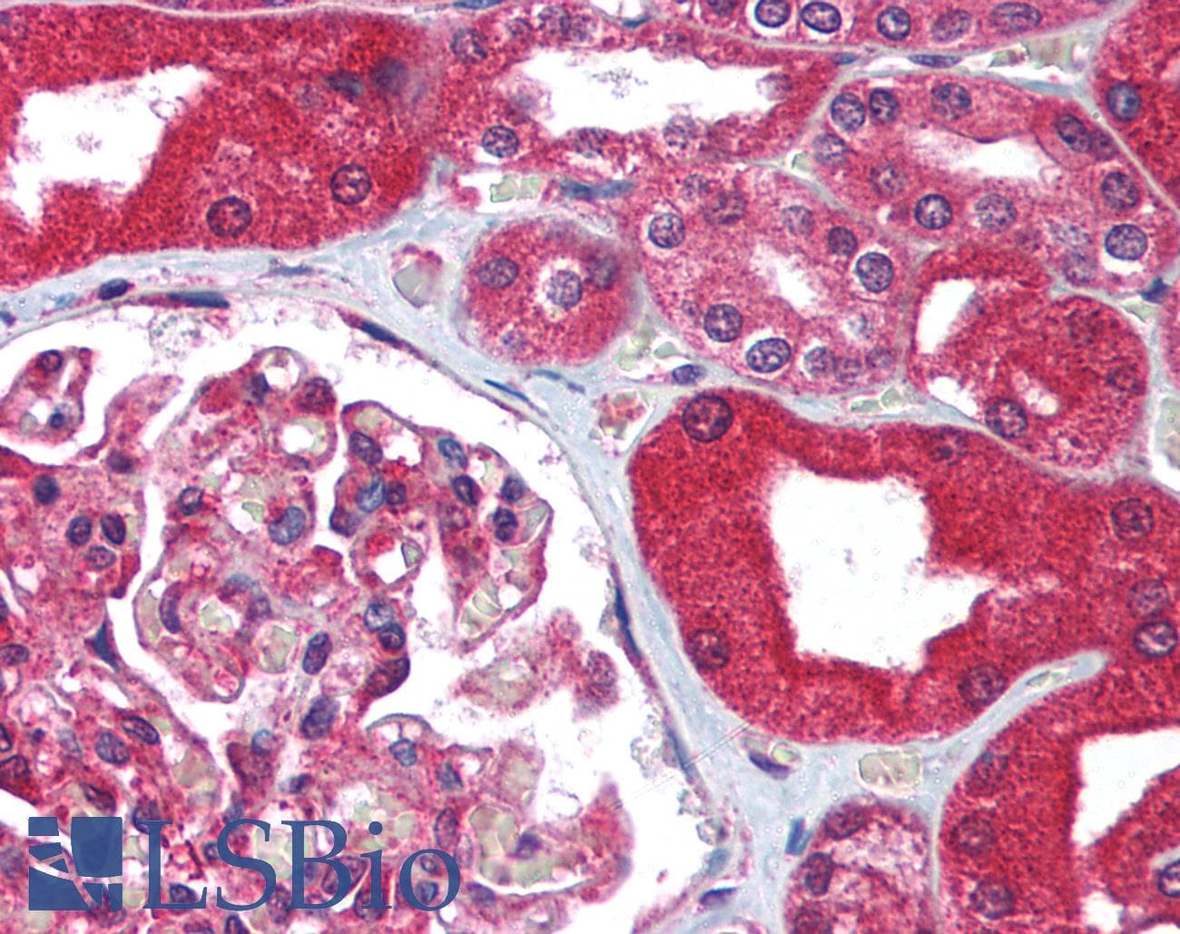 IHC-plus™ ABCB1 / MDR1 / P Glycoprotein Antibody