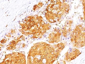 ARG1 / Arginase 1 Antibody (aa1-150, clone ARG1/1125 + ARG1/1126)