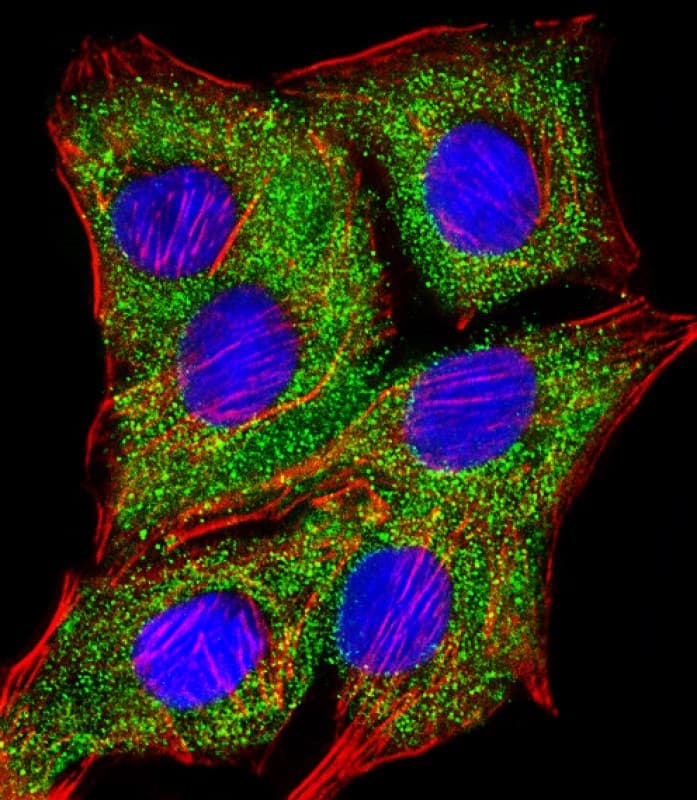 TIMP2 Antibody (clone 1554CT494.262.47)