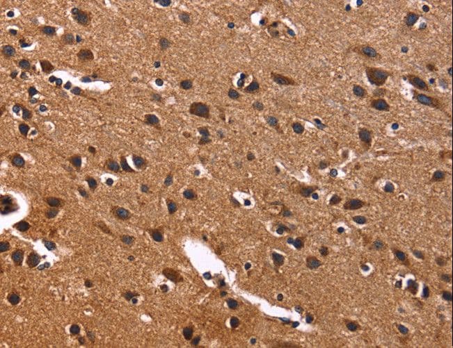 PHB / Prohibitin Antibody