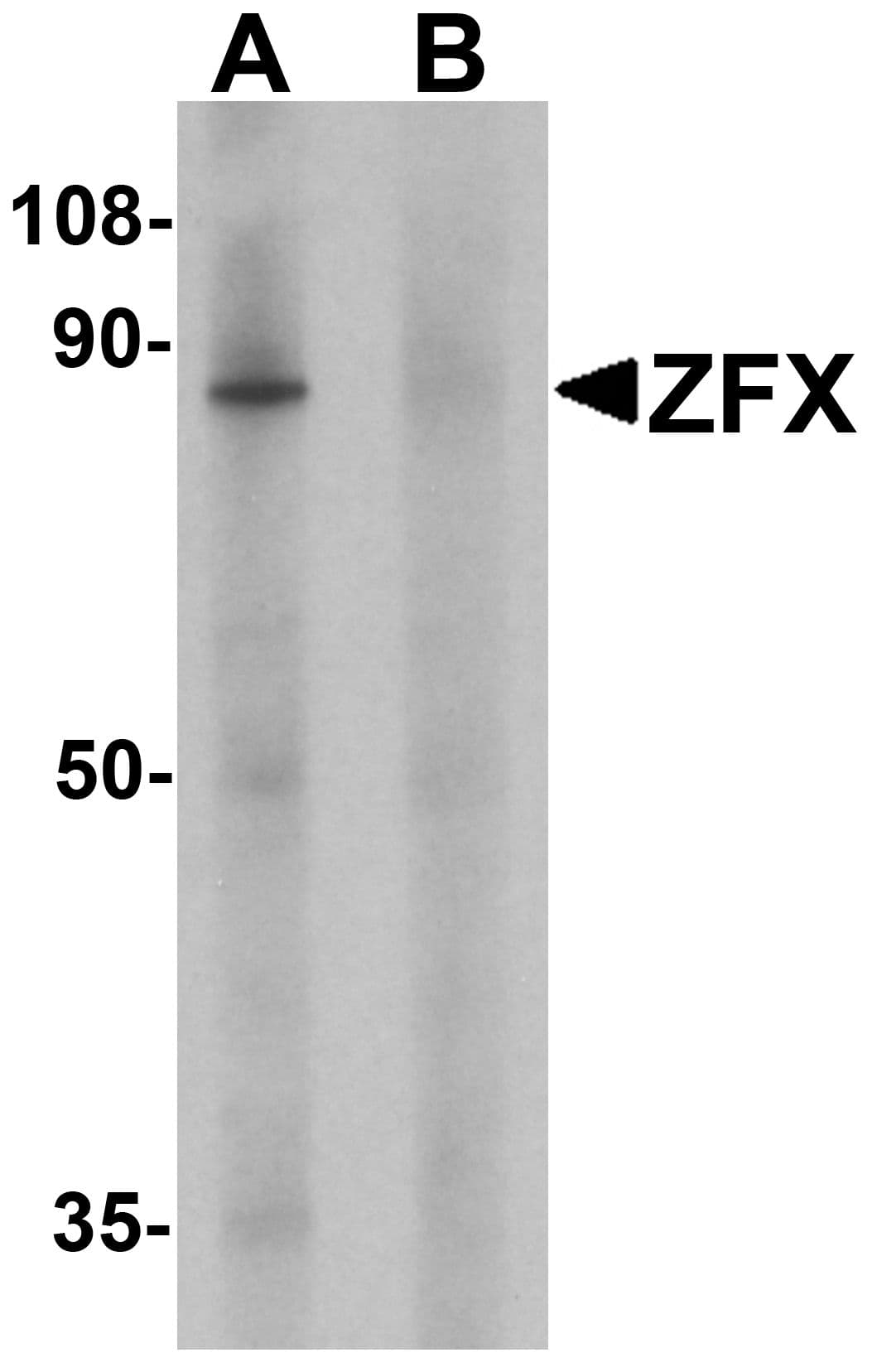 ZFX Antibody