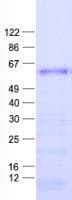 Human ZNF582 Protein (Recombinant His, N-Terminal)