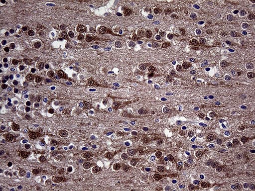 DIRAS2 Antibody (aa1-196, clone OTI10G5)