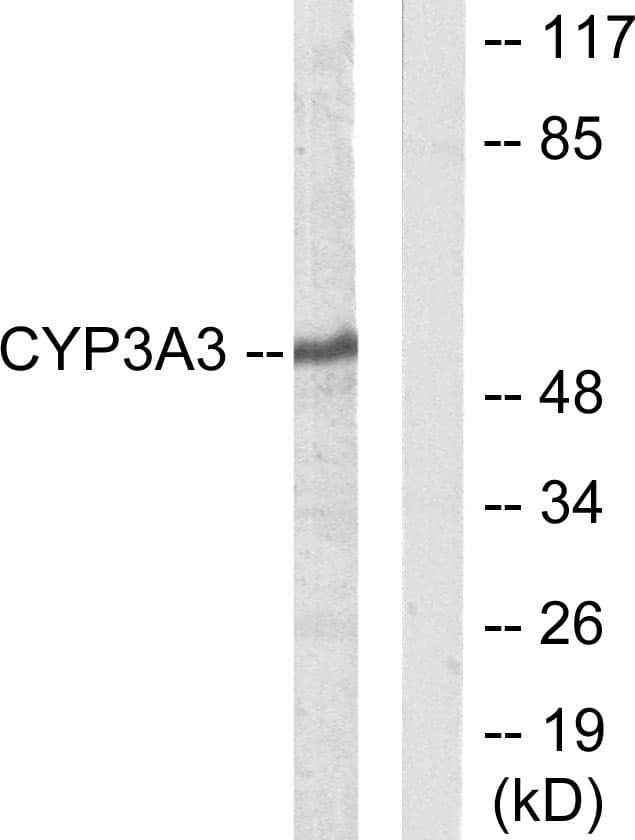 Polyclonal Rabbit anti-Human CYP3A4+5 Antibody (aa251-300, WB)