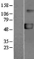 P2RX5 / P2X5 Protein (Over-Expression Lysate Myc-DDK (Flag))