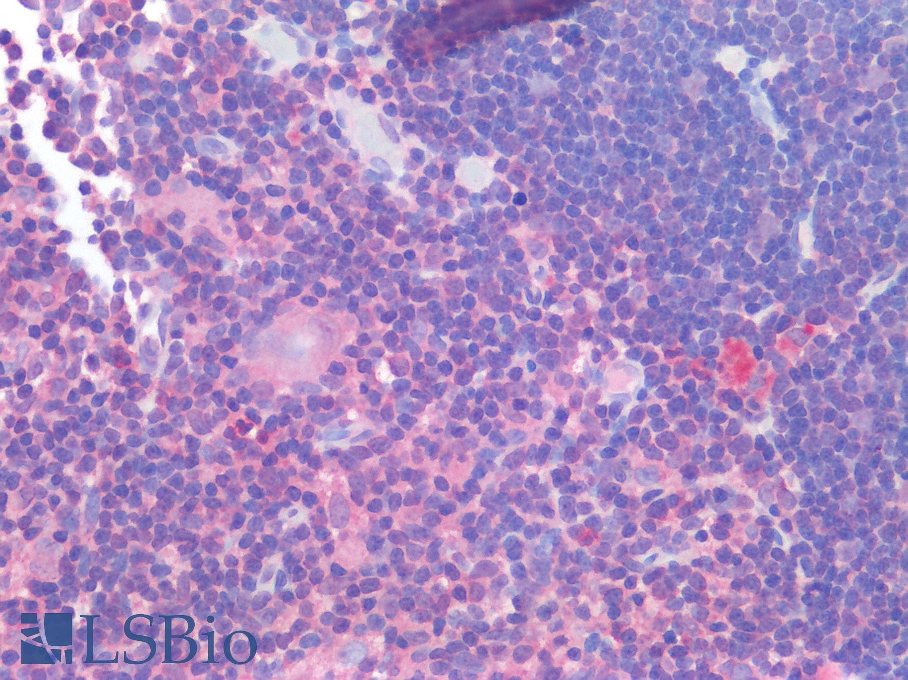 IHC-plus™ Polyclonal Rabbit anti-Human IL-1B / IL-1 Beta Antibody (IHC)