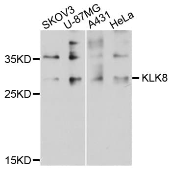 Polyclonal Rabbit anti-Human KLK8 / Kallikrein 8 Antibody (IHC, WB)