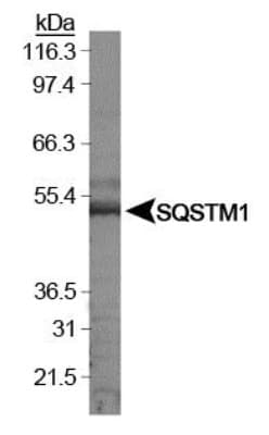 SQSTM1 Antibody (aa400-450, DY488)