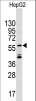 Polyclonal Rabbit anti-Human ANGEL2 Antibody (aa108-138, IHC, WB)