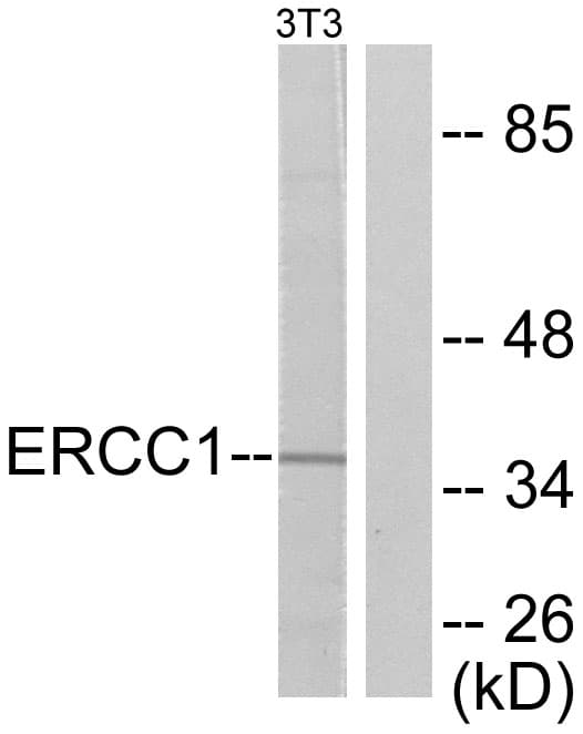 ERCC1 Antibody (aa141-190)